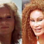 Jocelyn Wildenstein before and after plastic surgery (01)