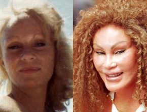 Jocelyn Wildenstein before and after plastic surgery (01)