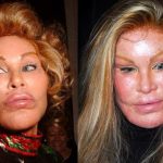Jocelyn Wildenstein before and after plastic surgery (02)