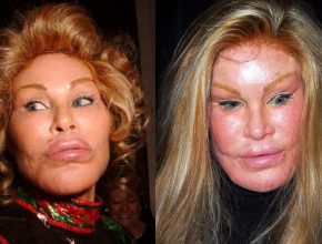 Jocelyn Wildenstein before and after plastic surgery (02)