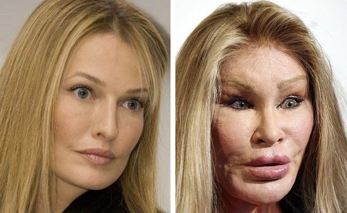 Jocelyn Wildenstein before and after plastic surgery