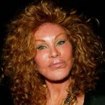 Jocelyn Wildenstein plastic surgery (00)