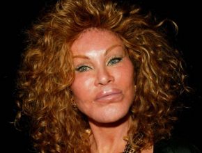 Jocelyn Wildenstein plastic surgery (00)