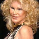 Jocelyn Wildenstein plastic surgery (01)