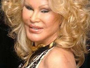 Jocelyn Wildenstein plastic surgery (01)