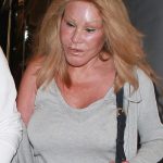 Catwoman Jocelyn Wildenstein plastic surgery (1)