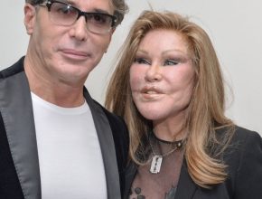 Jocelyn Wildenstein plastic surgery (10)