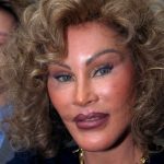 Jocelyn Wildenstein plastic surgery (11)