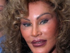 Jocelyn Wildenstein plastic surgery (11)