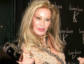 Jocelyn Wildenstein plastic surgery (15)