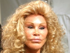 Jocelyn Wildenstein plastic surgery (16)