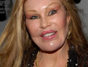 Jocelyn Wildenstein plastic surgery