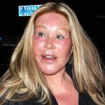 Jocelyn Wildenstein plastic surgery (2)