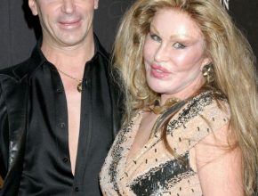 Jocelyn Wildenstein plastic surgery (21)