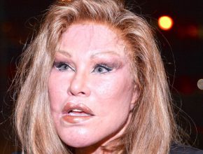 Jocelyn Wildenstein plastic surgery (22)