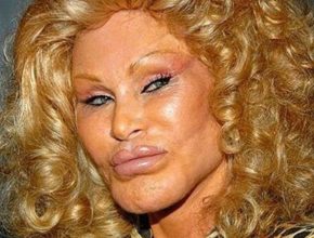 Jocelyn Wildenstein plastic surgery (24)