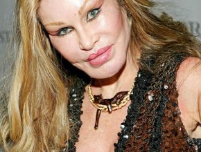 Jocelyn Wildenstein plastic surgery (27)