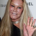 Jocelyn Wildenstein plastic surgery (3)