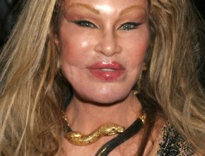 Jocelyn Wildenstein plastic surgery (30)