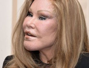 Jocelyn Wildenstein plastic surgery (32)