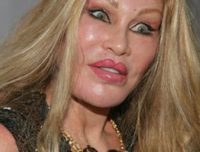 Jocelyn Wildenstein plastic surgery (35)