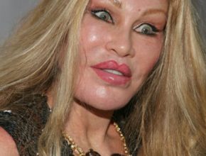 Jocelyn Wildenstein plastic surgery (35)