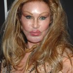 Jocelyn Wildenstein plastic surgery (4)