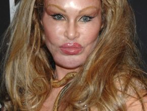 Jocelyn Wildenstein plastic surgery (4)