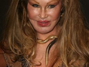 Jocelyn Wildenstein plastic surgery (6)