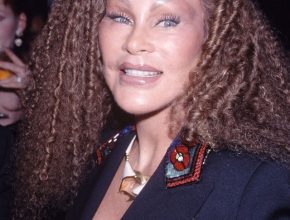 Jocelyn Wildenstein plastic surgery (7)