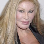 Jocelyn Wildenstein plastic surgery (8)