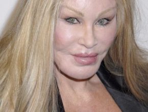 Jocelyn Wildenstein plastic surgery (8)