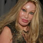 Jocelyn Wildenstein plastic surgery (9)