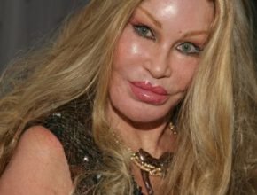 Jocelyn Wildenstein plastic surgery (9)