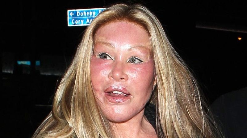 Jocelyn Wildenstein plastic surgery