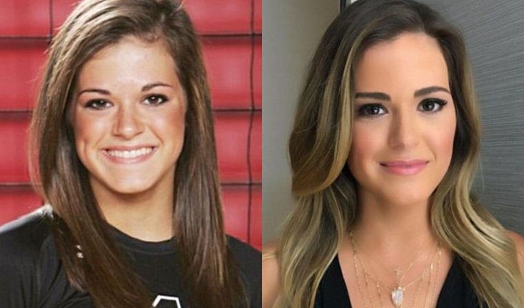 Jojo Fletcher before and after plastic surgery