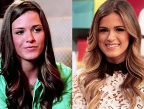 Jojo Fletcher before and after plastic surgery (28)
