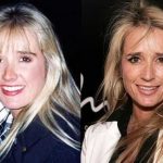 Kim Richards before and after plastic surgery (38)