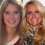 Kim Richards before and after plastic surgery (5)