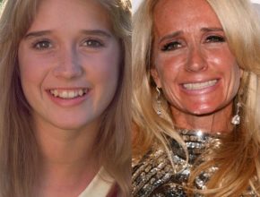 Kim Richards before and after plastic surgery (5)