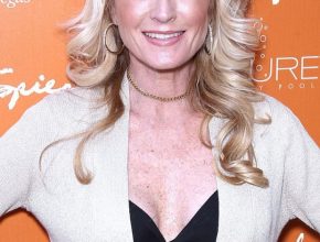 Kim Richards plastic surgery (1)