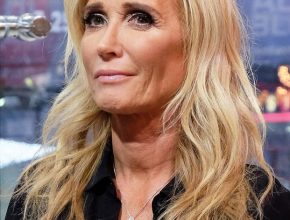 Kim Richards plastic surgery (22)