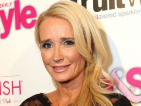 Kim Richards plastic surgery (25)