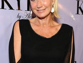 Kim Richards plastic surgery (27)