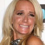 Kim Richards plastic surgery (29)