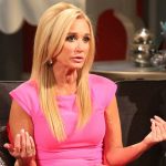 Kim Richards plastic surgery (4)