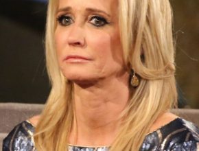 Kim Richards plastic surgery (40)