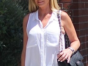 Kim Richards plastic surgery (41)