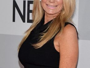 Kim Richards plastic surgery (9)