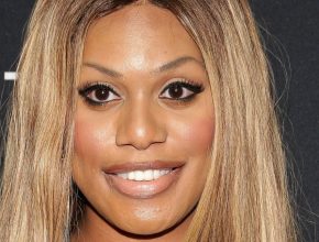 Laverne Cox plastic surgery (21)